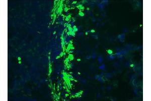 Image no. 2 for anti-Desmin (DES) antibody (ABIN335360)