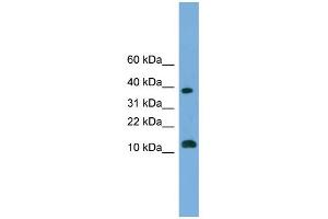 WB Suggested Anti-LOC152586 Antibody Titration: 0. (GL54D anticorps  (Middle Region))