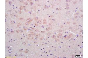 Formalin-fixed and paraffin embedded rat brain labeled with Rabbit Anti Phospho-NMDAR1(Ser890) Polyclonal Antibody, Unconjugated (ABIN744278) at 1:200 followed by conjugation to the secondary antibody and DAB staining (GRIN1/NMDAR1 anticorps  (pSer890))