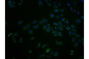 Immunofluorescence staining of A549 cells with ABIN7143977 at 1:100, counter-stained with DAPI. (SCNN1D anticorps  (AA 292-519))