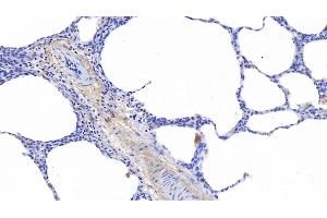 Detection of ELN in Human Lung Tissue using Polyclonal Antibody to Elastin (ELN)