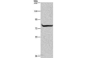 Western blot analysis of 293T cell, using GYS1 Polyclonal Antibody at dilution of 1:300 (Glycogen Synthase 1 anticorps)
