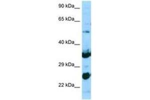 Image no. 1 for anti-N-Acetylneuraminate Pyruvate Lyase (Dihydrodipicolinate Synthase) (NPL) (AA 61-110) antibody (ABIN6748246) (NPL anticorps  (AA 61-110))