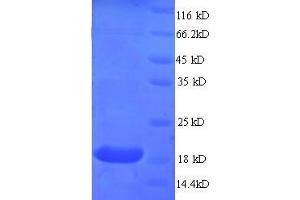 Myosin, Light Chain 2, Regulatory, Cardiac, Slow (MYL2) (AA 8-164), (partial) protein (His tag)
