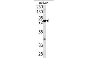 MCCC1 Antibody (Center) (ABIN651863 and ABIN2840428) western blot analysis in mouse liver tissue lysates (15 μg/lane). (MCCC1 anticorps  (AA 397-425))