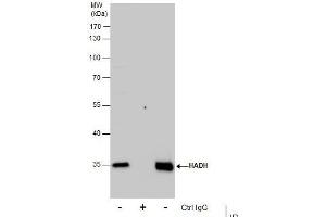 IP Image Immunoprecipitation of HADH protein from HepG2 whole cell extracts using 5 μg of HADH antibody, Western blot analysis was performed using HADH antibody, EasyBlot anti-Rabbit IgG  was used as a secondary reagent.
