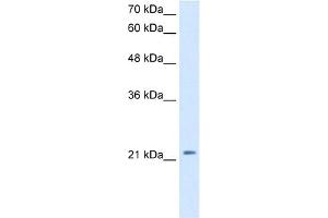 WB Suggested Anti-DKK1 Antibody Titration:  2. (DKK1 anticorps  (C-Term))