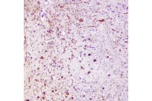 IHC analysis of Calbindin using anti-Calbindin antibody (ABIN6719541). (CALB1 anticorps  (AA 2-261))
