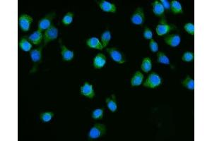 IF analysis of Dicer/DICER1 using anti-Dicer/DICER1 antibody (ABIN7600147).