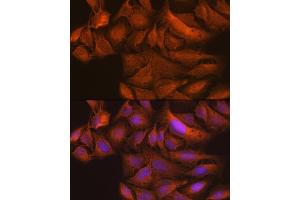 Immunofluorescence analysis of U-2 OS cells using TBK1/NAK Rabbit mAb (ABIN7270723) at dilution of 1:100 (40x lens).
