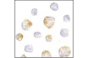 Immunocytochemistry of KIF5 in K562 cells with this product at 5 μg/ml. (KIF5A anticorps  (Center))