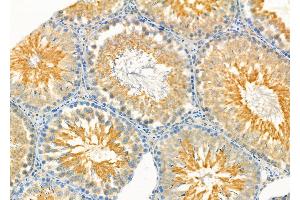 ABIN6257250 and ABIN6273924 at 1/100 staining Rat testis tissue by IHC-P.
