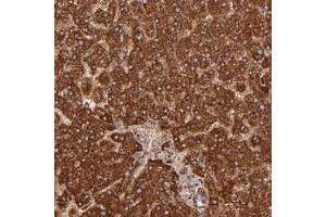Immunohistochemical staining of human liver with SH2D4A polyclonal antibody  shows strong cytoplasmic positivity in hepatocytes at 1:50-1:200 dilution. (SH2D4A anticorps)
