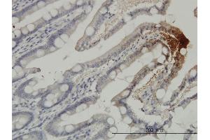 Immunoperoxidase of monoclonal antibody to THTPA on formalin-fixed paraffin-embedded human small Intestine.