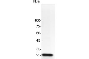 SDS-PAGE (SDS) image for Fibroblast Growth Factor 21 (FGF21) (Active) protein (His tag) (ABIN7884368)