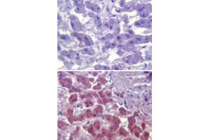 Immunohistochemical analysis of TLR6 in paraffin-embedded formalin-fixed human liver tissue using an isotype control (top) and TLR6 monoclonal antibody, clone 86B1153. (TLR6 anticorps  (AA 408-424))