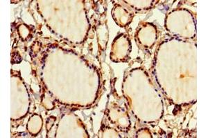 Immunohistochemistry of paraffin-embedded human thyroid tissue using ABIN7169707 at dilution of 1:100 (SIRPB1 anticorps  (AA 30-371))