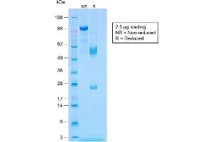 anti-Calponin 1 (CNN1) antibody