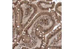 Immunohistochemical staining of human duodenum with ATAD2B polyclonal antibody  shows moderate cytoplasmic and nuclear positivity in glandular cells at 1:50-1:200 dilution.