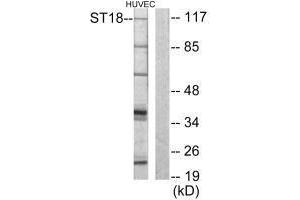 Western blot analysis of extracts from HUVEC cells, using ZNF387 antibody. (ST18 anticorps  (N-Term))