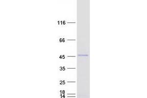 Validation with Western Blot