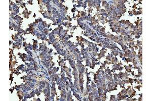 IHC analysis of GAPDH using anti-GAPDH antibody (ABIN5518757).