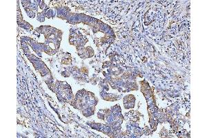 IHC analysis of Grp75 using anti-Grp75 antibody (ABIN7602782). (HSPA9 anticorps  (C-Term))