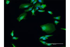 Immunofluorescence of purified MaxPab antibody to DGCR8 on HeLa cell.