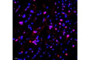 Immunofluorescence of paraffin embedded mouse heart using PRPF3 (ABIN7075311) at dilution of 1: 2200 (400x lens)