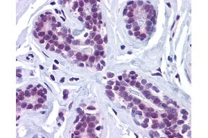 Anti-RBBP8 / CTIP antibody IHC of human breast. (Retinoblastoma Binding Protein 8 anticorps  (Internal Region))