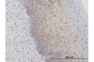 Immunoperoxidase of purified MaxPab antibody to RPL29 on formalin-fixed paraffin-embeddedhuman uterine cervix. (RPL29 anticorps  (AA 1-159))