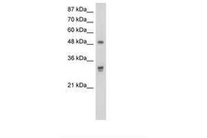 Image no. 1 for anti-DEAD (Asp-Glu-Ala-As) Box Polypeptide 19B (DDX19B) (AA 382-431) antibody (ABIN203175) (DDX19B anticorps  (AA 382-431))