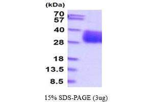 SDS-PAGE (SDS) image for Retinoic Acid Early Transcript 1E (RAET1E) (AA 29-227) protein (His tag) (ABIN5854722)