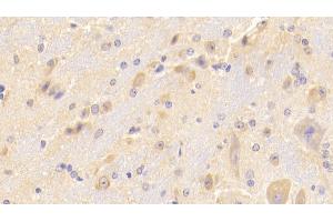 Detection of SCGN in Mouse Cerebellum Tissue using Polyclonal Antibody to Secretagogin (SCGN)