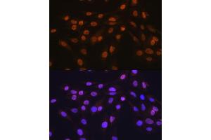 Immunofluorescence analysis of C6 cells using HuR/EL antibody (ABIN7266913).