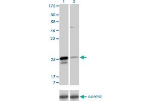 Western blot analysis of MS4A7 over-expressed 293 cell line, cotransfected with MS4A7 Validated Chimera RNAi (Lane 2) or non-transfected control (Lane 1). (MS4A7 anticorps  (AA 1-240))