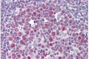 Human Tonsil (formalin-fixed, paraffin-embedded) stained with TGFB1I1 antibody ABIN462214 followed by biotinylated goat anti-rabbit IgG secondary antibody ABIN481713, alkaline phosphatase-streptavidin and chromogen.
