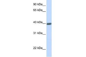WB Suggested Anti-MAGEA1 Antibody Titration:  0. (MAGEA1 anticorps  (N-Term))