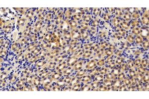 Detection of PKM2 in Mouse Kidney Tissue using Polyclonal Antibody to Pyruvate kinase isozymes M2 (PKM2)