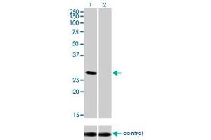 Western blot analysis of DLX4 over-expressed 293 cell line, cotransfected with DLX4 Validated Chimera RNAi (Lane 2) or non-transfected control (Lane 1). (DLX4 anticorps  (AA 1-98))