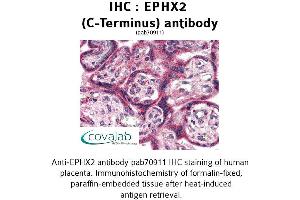 Image no. 2 for anti-Epoxide Hydrolase 2, Cytoplasmic (EPHX2) (C-Term) antibody (ABIN1734088) (EPHX2 anticorps  (C-Term))