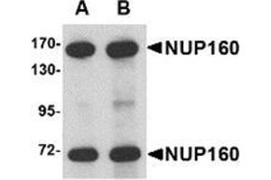 Western blot analysis of NUP160 in rat brain tissue lysate with NUP160 antibody at (A) 0. (NUP160 anticorps  (C-Term))