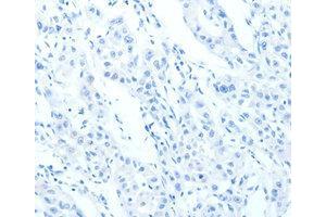 Immunohistochemistry (IHC) image for anti-Cadherin 23 (CDH23) antibody (ABIN1871707) (CDH23 anticorps)