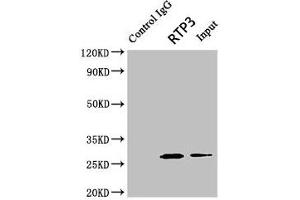 Immunoprecipitating RTP3 in Mouse brain tissue Lane 1: Rabbit control IgG (1 μg) instead of ABIN7167488 in Mouse brain tissue. (RTP3 anticorps  (AA 1-211))