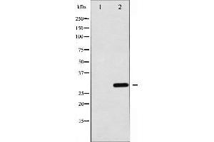 Western blot analysis of C/EBP-alpha expression in 293 whole cell lysates,The lane on the left is treated with the antigen-specific peptide.