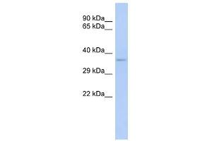 TRADD antibody (70R-10446) used at 0. (TRADD anticorps  (Middle Region))