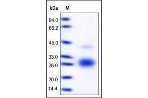 Human Fas Ligand, His Tag on SDS-PAGE under reducing (R) condition.