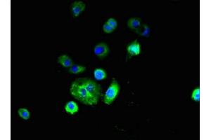 Immunofluorescent analysis of A431 cells using ABIN7151164 at dilution of 1:100 and Alexa Fluor 488-congugated AffiniPure Goat Anti-Rabbit IgG(H+L)