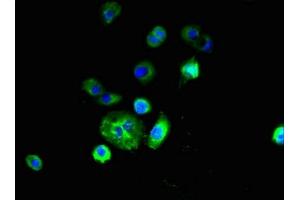 Immunofluorescent analysis of A431 cells using ABIN7151164 at dilution of 1:100 and Alexa Fluor 488-congugated AffiniPure Goat Anti-Rabbit IgG(H+L) (RNF182 anticorps  (AA 1-160))