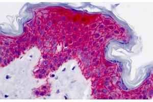 Human Skin: Formalin-Fixed, Paraffin-Embedded (FFPE) (Syndecan 1 anticorps)